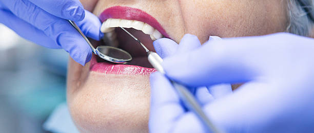 Best Emergency Dental Surgery in Attica, IN